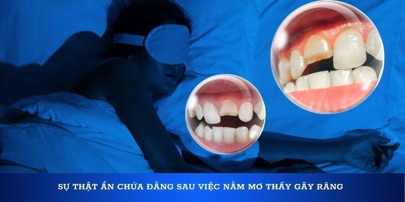Gãy răng đánh số mấy? Luận giải ý nghĩa mơ thấy gãy răng