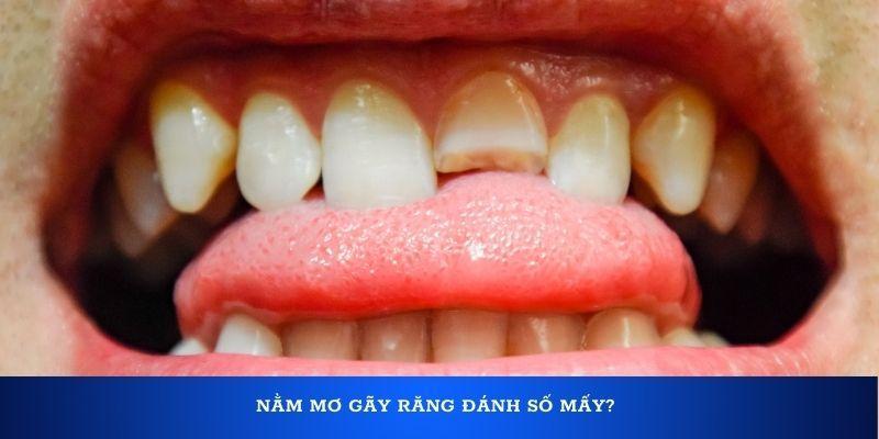 Nằm mơ gãy răng đánh số mấy?
